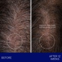 Augustinus Bader The Scalp Treatment